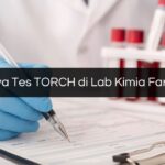 Biaya Tes TORCH di Lab Kimia Farma